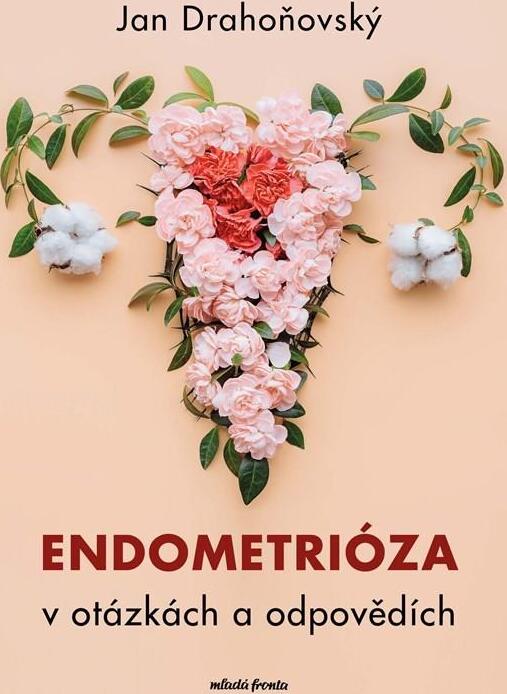 Endometrióza v otázkách a odpovědích